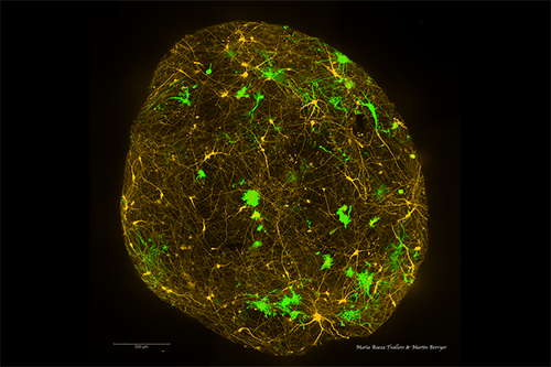 iPSC-derived brain organoid