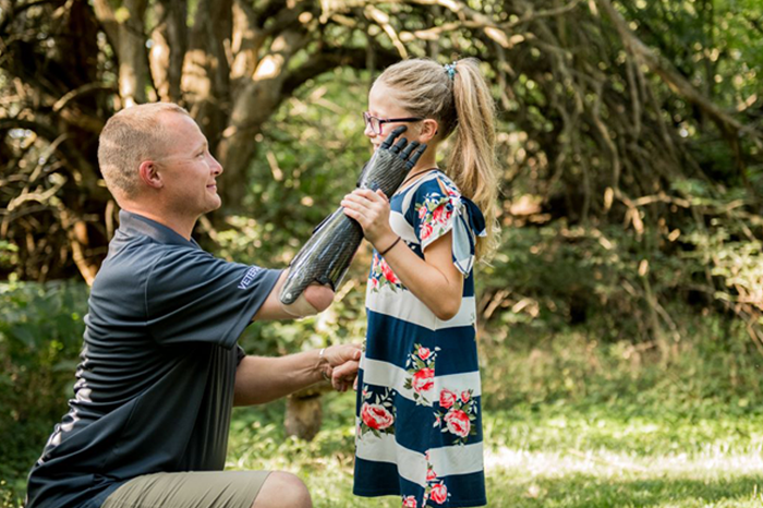 PSYONIC is transforming lives with advanced prosthetics.  

